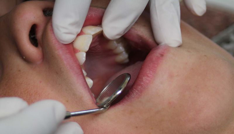 ¿Cómo atender a pacientes en su salud bucodental en tiempos de Covid?