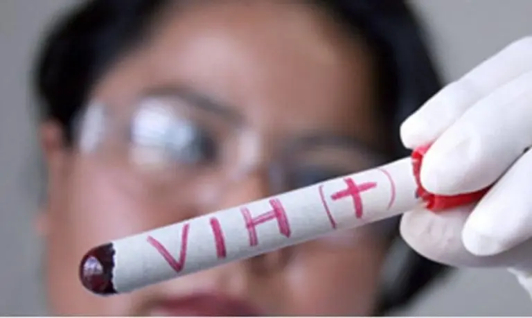 Científicos eliminan el VIH de células infectadas
