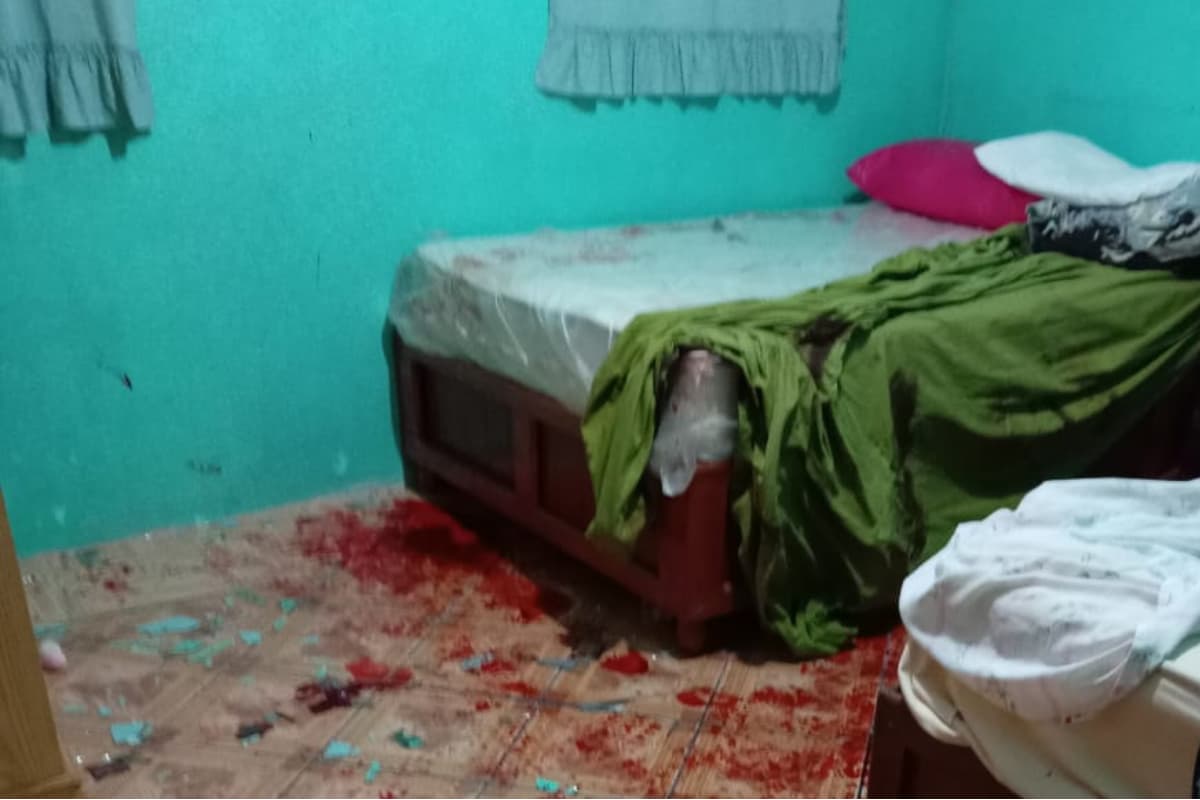 2.El hombre utilizó un vidrio para atentar contra su vida, según reportes oficiales