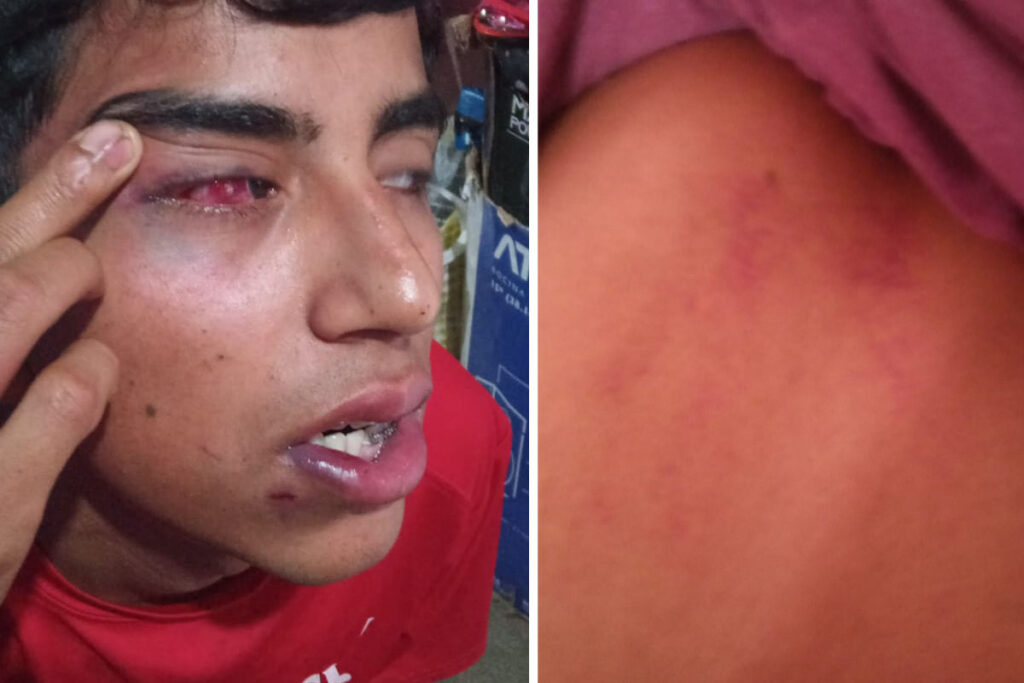 En lo que va del año, se han denunciado dos casos de maltrato físico en anexos