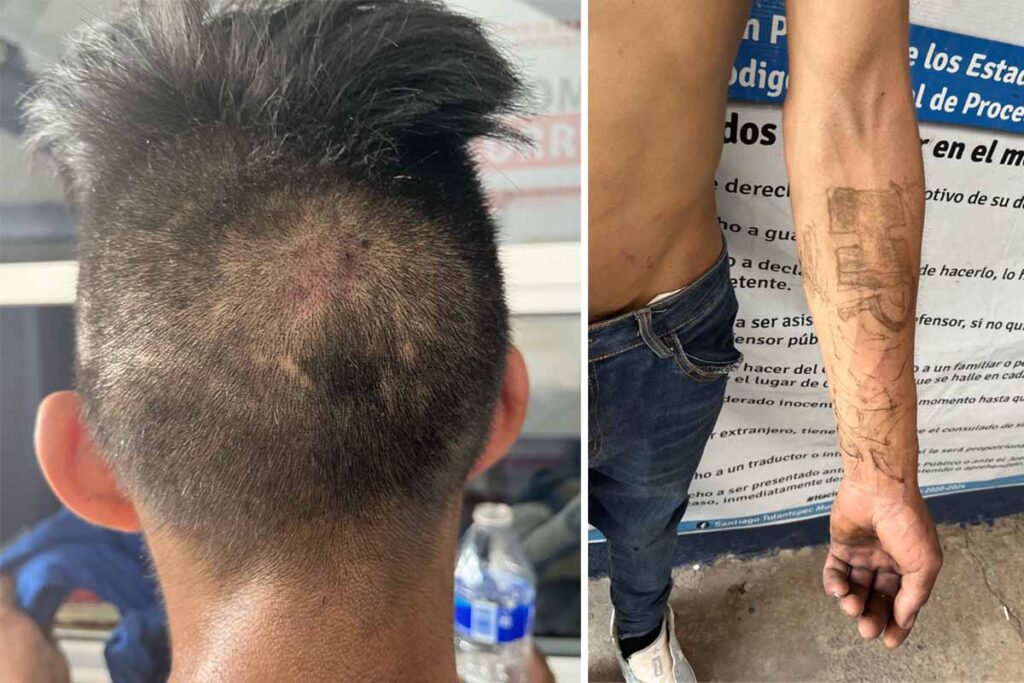 Vecinos retuvieron, golpearon y amarraron a un poste, a un hombre, de 20 años de edad