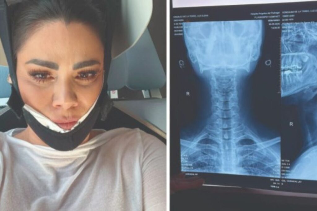 Actriz Luz Elena González sufrió un accidente que casi pone su vida en peligro