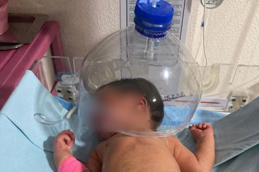 Bebé de Tabasco, víctima de la falta de insumos en el IMSS Bienestar; así le suministraron oxígeno