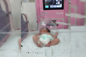 La menor fue estabilizada por médicos y continúa en observación en el área de neonatología