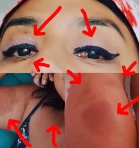 Mar ha sufrido violencia física y sexual por parte de su expareja