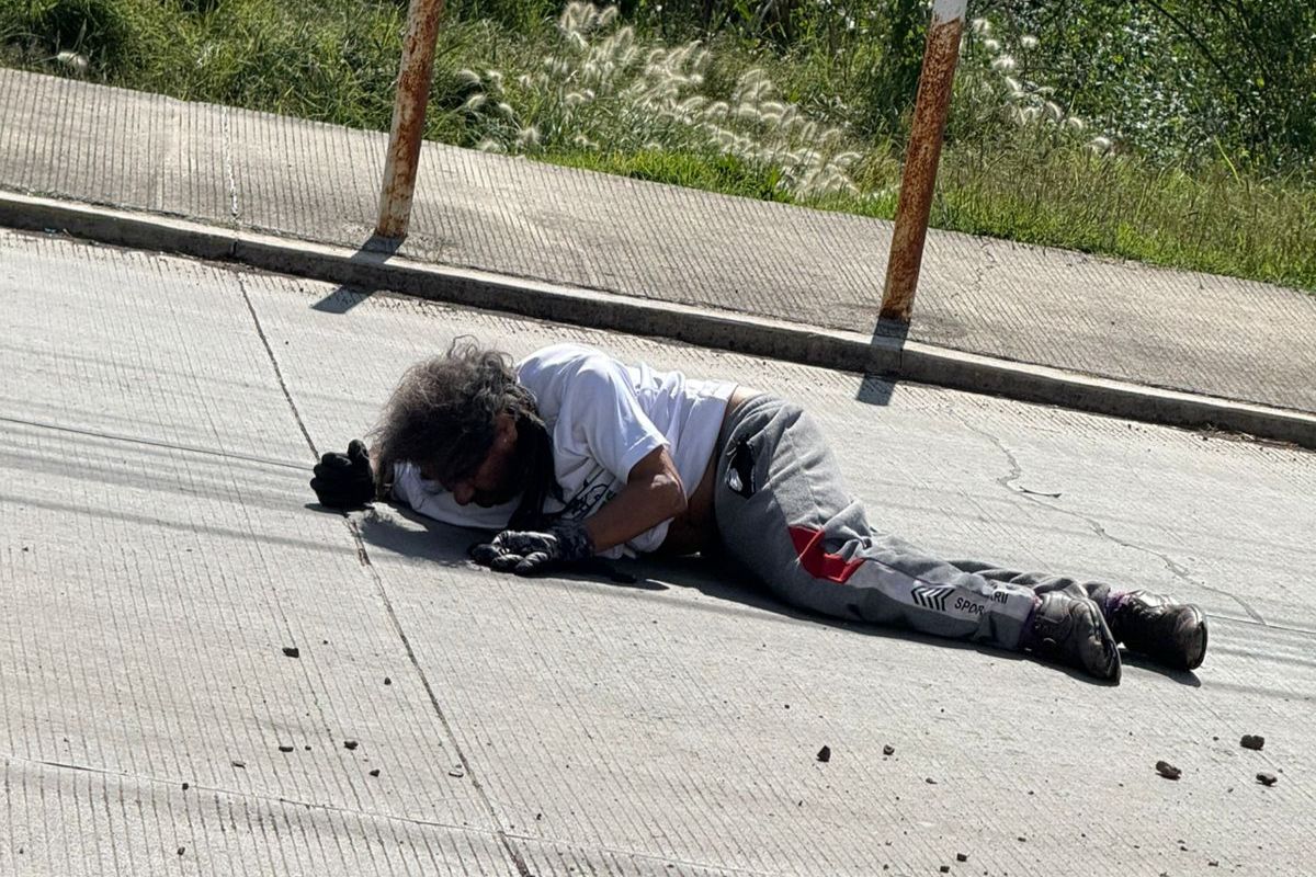 Fracturas en un ciclista tras ser atropellado por vehículo en Santiago Tulantepec