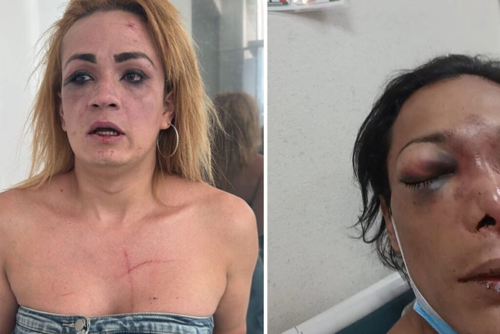 El pasado 3 de septiembre, fueron agredidas nuevamente por Karen Quintero dentro de una entrega de apoyos del Bienestar