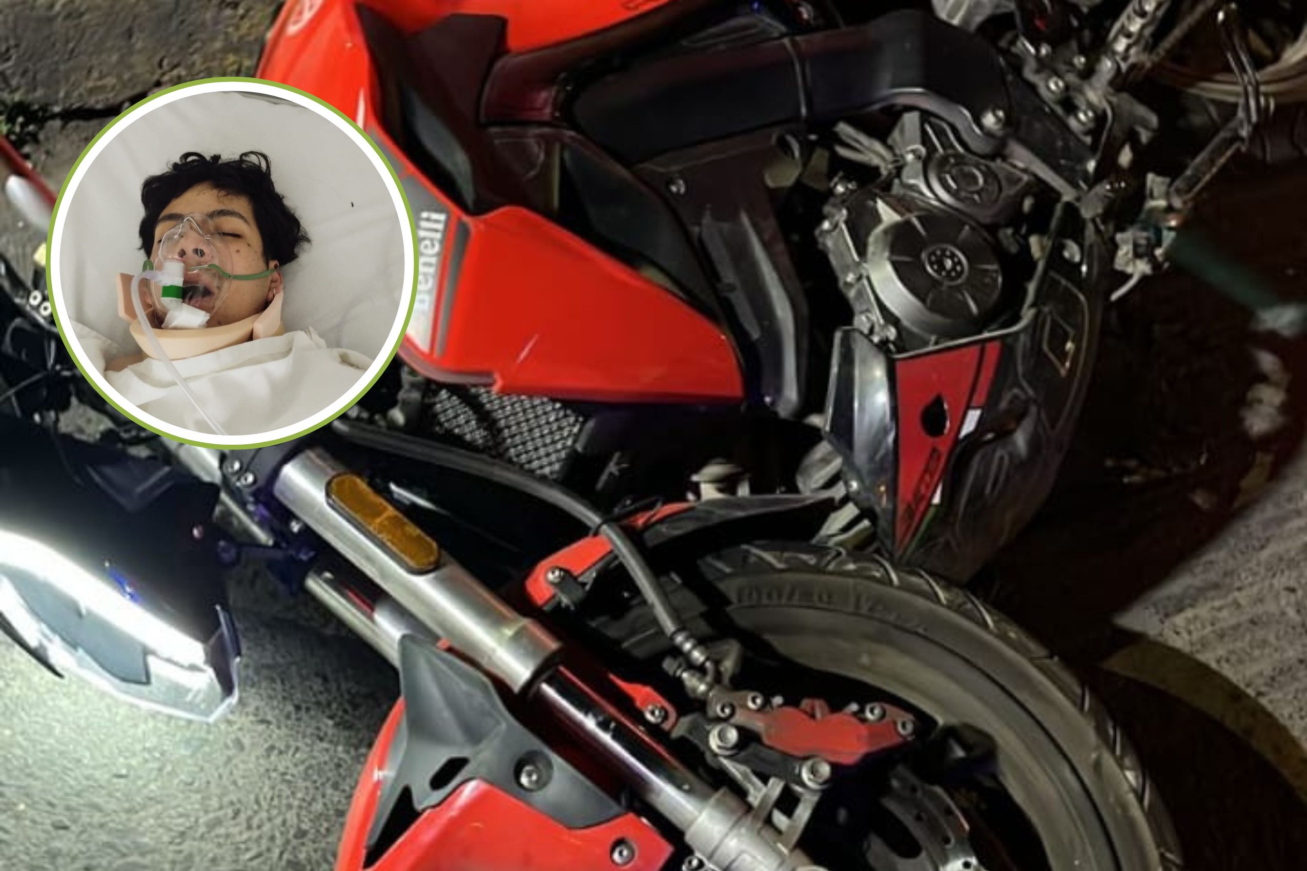El joven motociclista fue trasladado grave al Hospital General de Tulancingo.