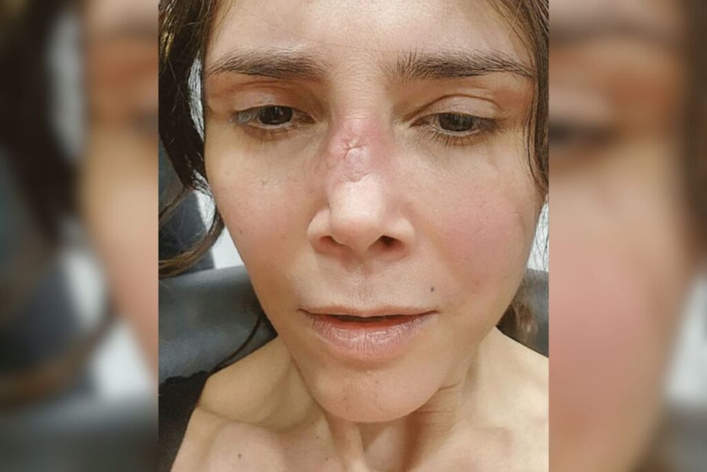 La modelo Dorismar ya mostró los primeros resultados de su recuperación tras mala praxis