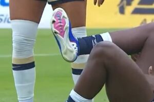 La lesión de Ihezuo en Tuzas ocurrió tras un choque en el Estadio Olímpico Universitario