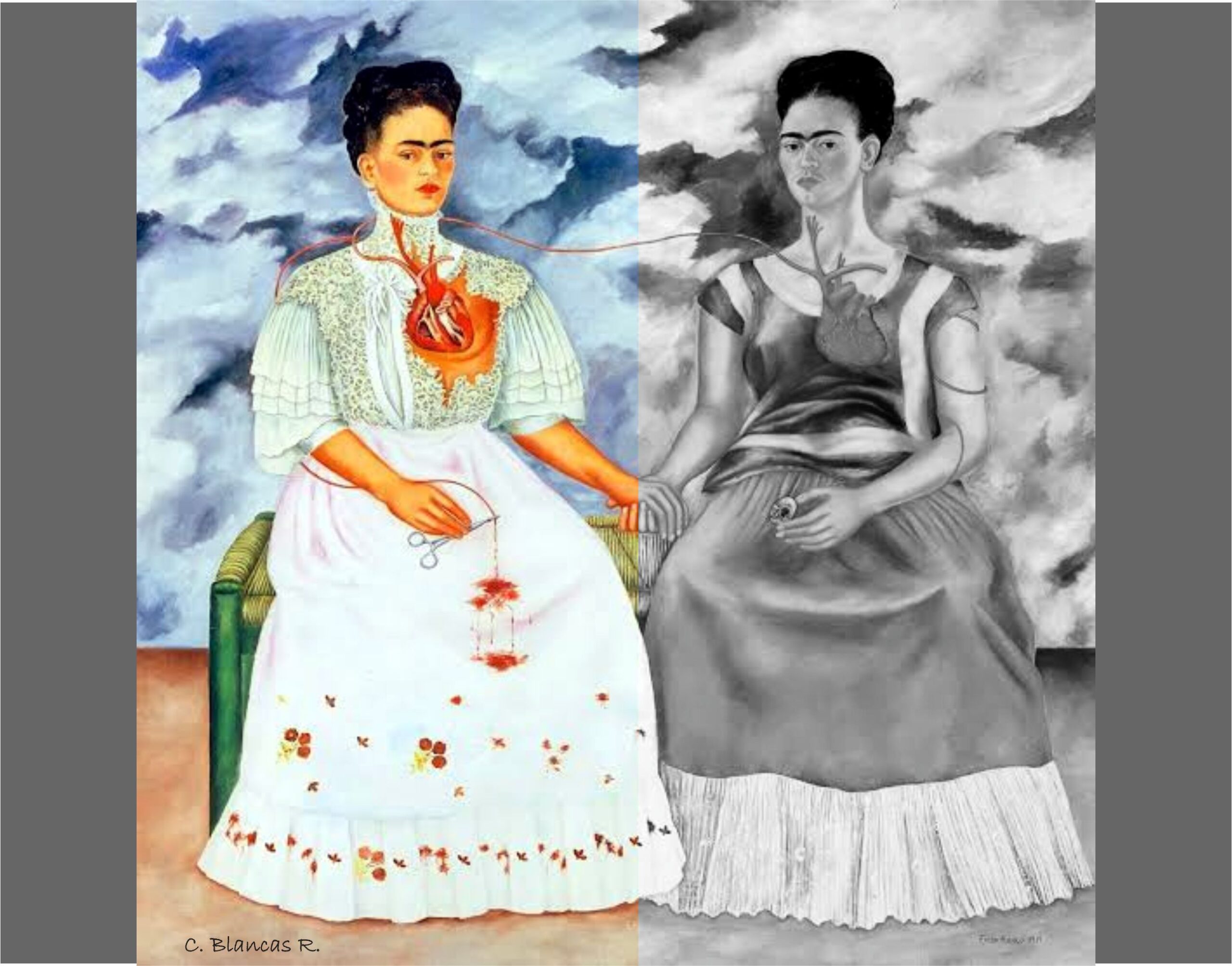 Blancas: Plagio